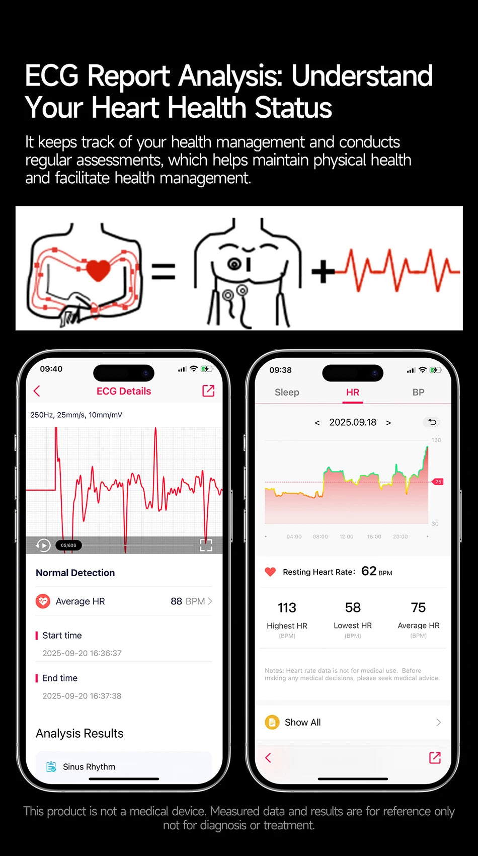 2026 Fashion New Expert level Health Smart Watch Men ECG+PPG Laser Monitor Uric Acid Blood Fat Blood Pressure HD Call Smartwatch